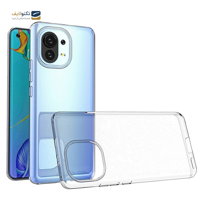 gallery-قاب ژلهای شفاف داخل کارتون مناسب برای گوشی شیائومی مدل mi 11 lite-gallery-0-TLP-4123_80a6e05f-7440-43e4-9157-326350c56c23.png gallery-قاب ژلهای شفاف داخل کارتون مناسب برای گوشی شیائومی مدل mi 11 lite-gallery-0-TLP-4123_80a6e05f-7440-43e4-9157-326350c56c23.png