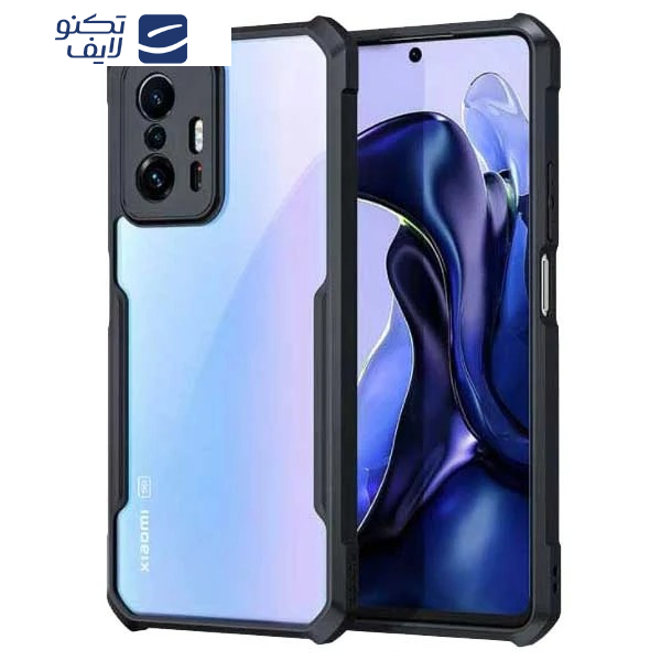 کاور ویواتل مدل XUNOD مناسب برای گوشی موبایل شیائومی Mi 11T 5G / Mi 11T Pro 5G