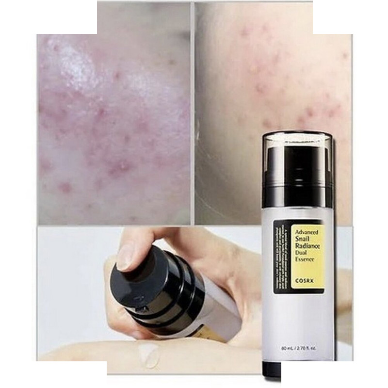 سرم پوست کوزارکس مدل Dual Essence حجم 80 میلی لیتر سرم پوست کوزارکس مدل Dual Essence حجم 80 میلی لیتر
