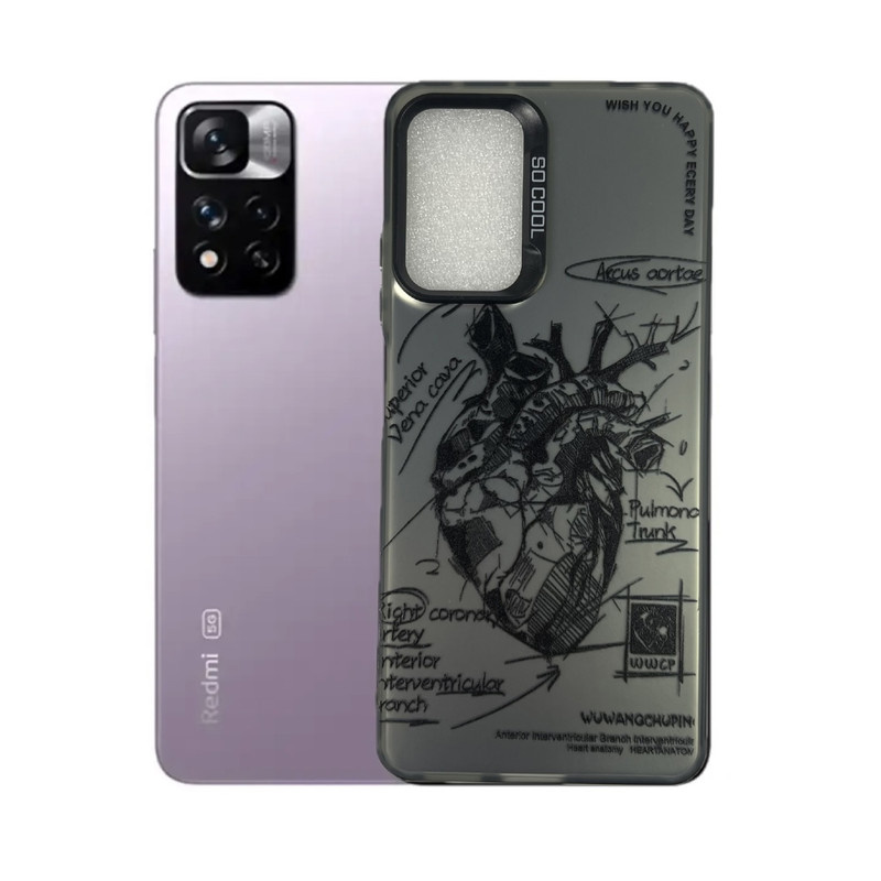 کاور طرح تشریح قلب مناسب برای گوشی موبایل شیائومی Redmi Note 11 Pro 4g