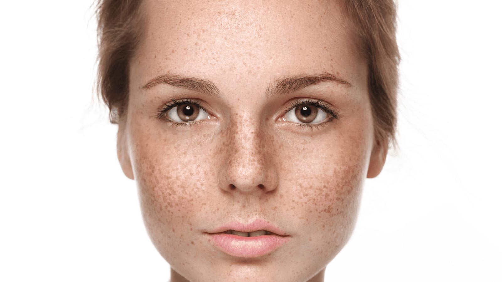 چگونه لکه های قهوه ای صورت را از بین ببریم؟ درمان، پیشگیری + ماسک‌های مناسب